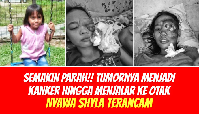 Update Kondisi Shyla Tanggal 26 Juni 2026