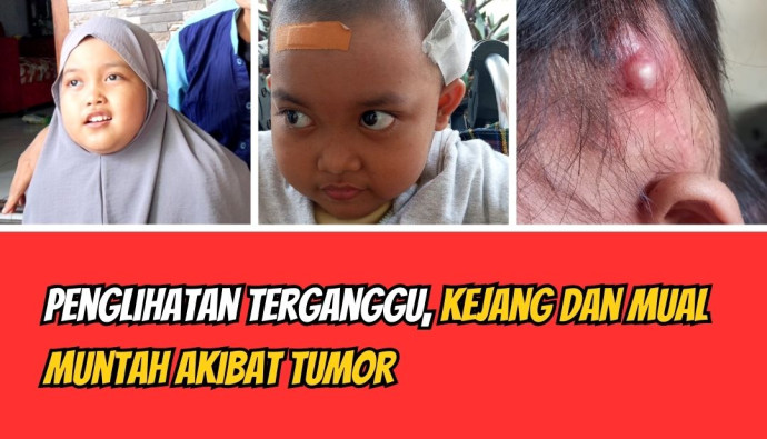 Update Kondisi Putri Tanggal 03 Januari 2026