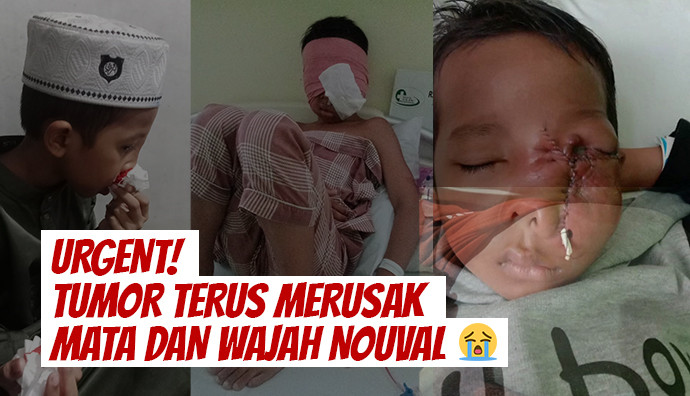 Update Kondisi Nouval 10 Oktober 2025