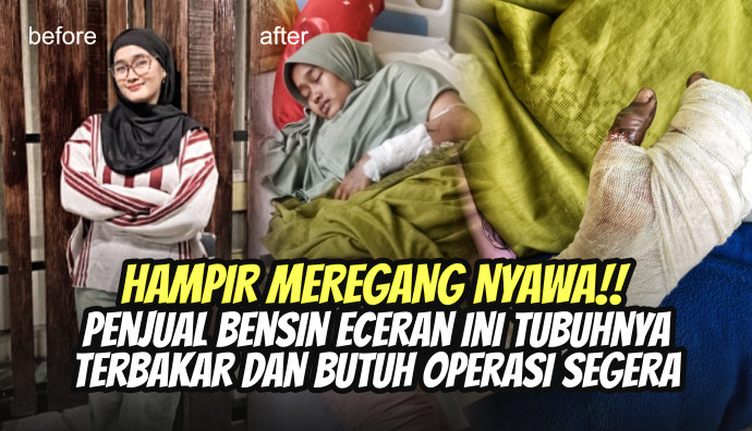 Update Kondisi Ibu Aisah 03 November 2025