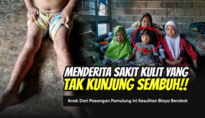 Update Kondisi Siti 17 November 2025