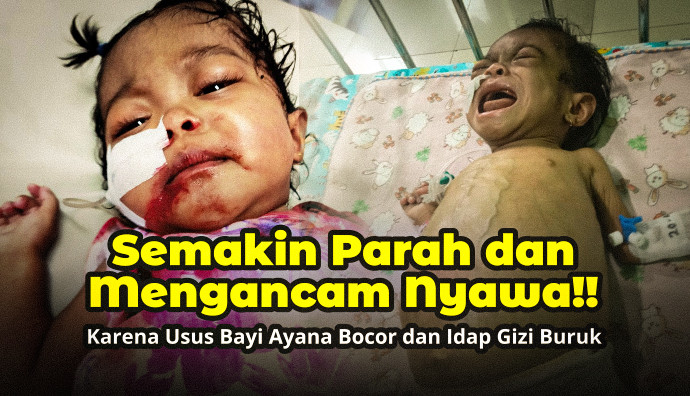 Kabar Duka Datang Dari Ayana