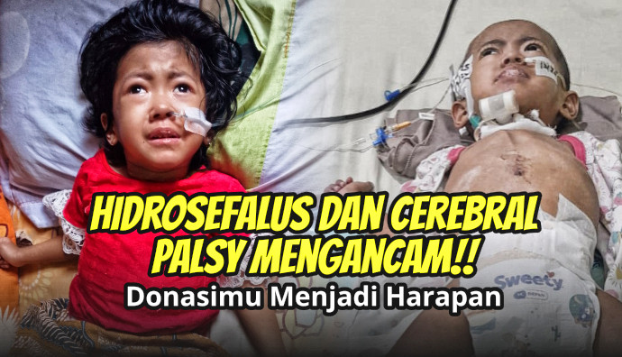 Update Kondisi Arumi Tanggal 17 Juni 2026