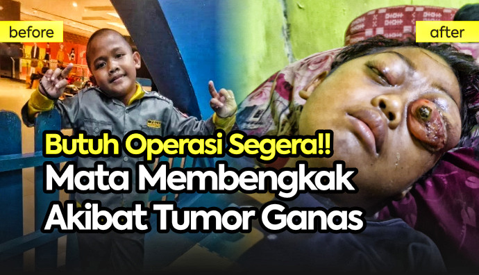 Update Kondisi Keluarga Alm Brayen Tanggal 23 Mei 2026