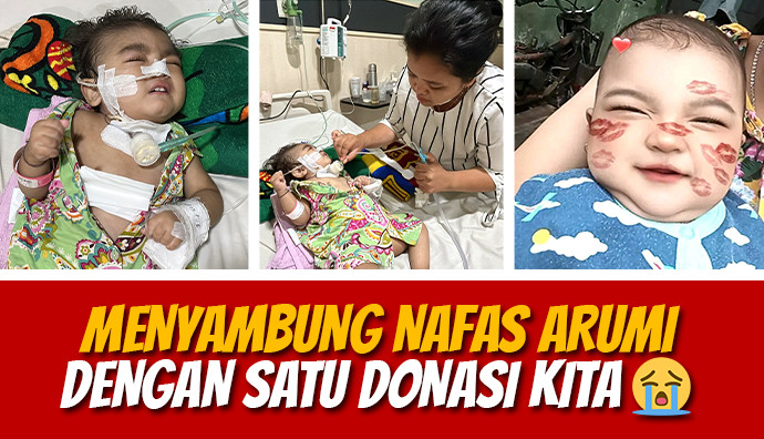 Update Kondisi Arumi Tanggal 26 Juni 2026