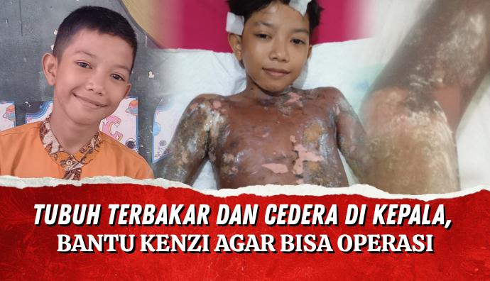 Update Kondisi Kenzie Tanggal 12 Agustus 2026