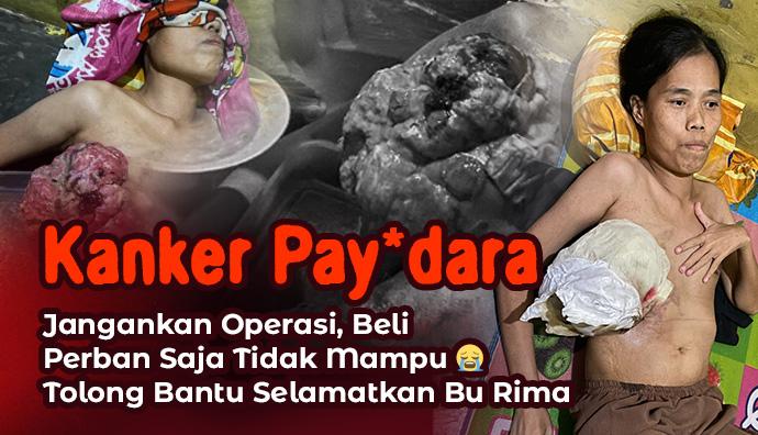 Update Terbaru Ibu Rima: Bantuan Tahap Pertama Telah Tersalurkan