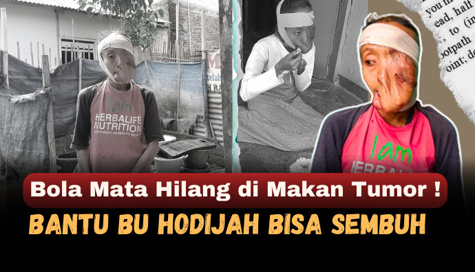Update Kondisi Ibu Hodijah 08 November 2025